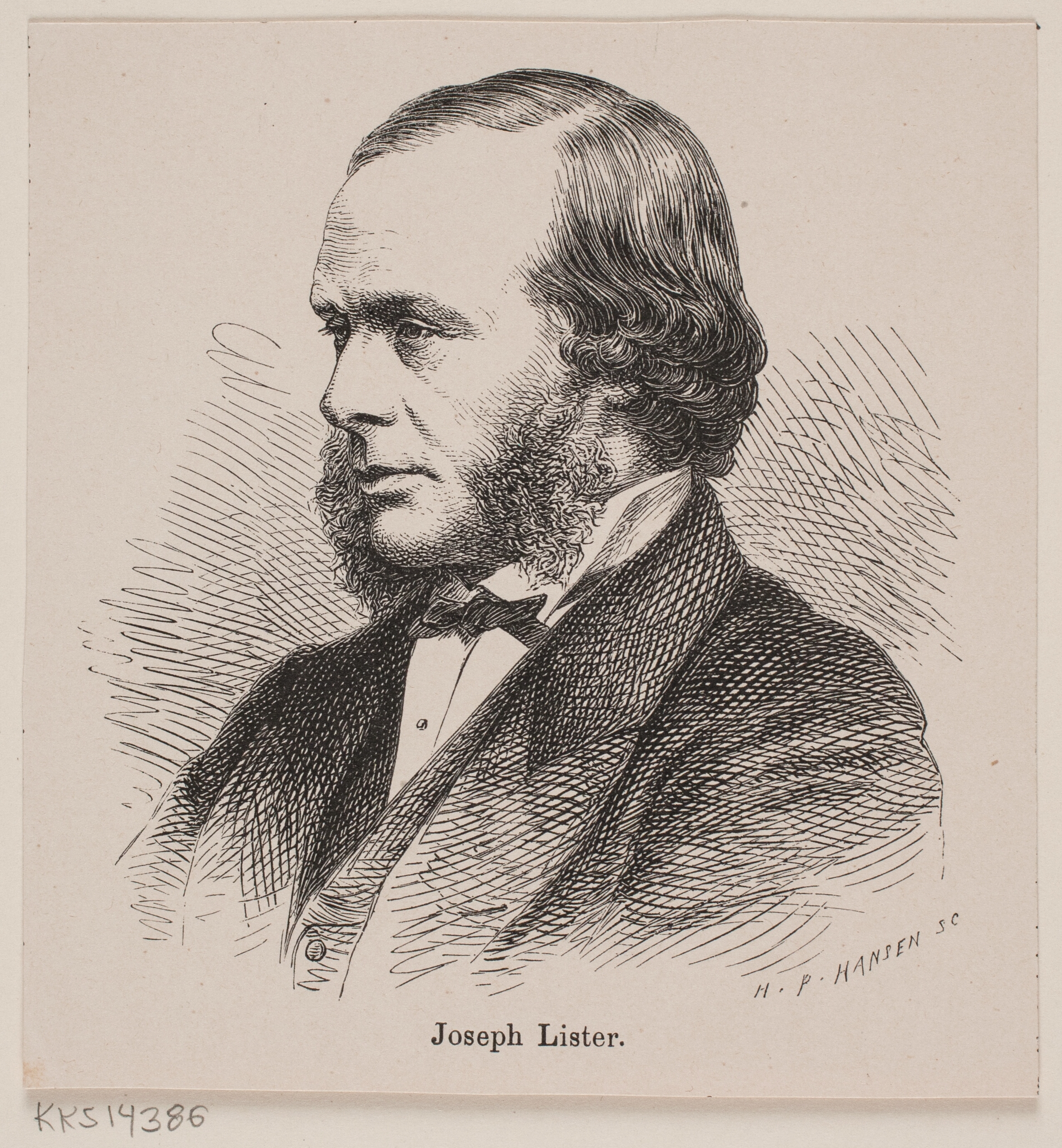 Joseph Lister