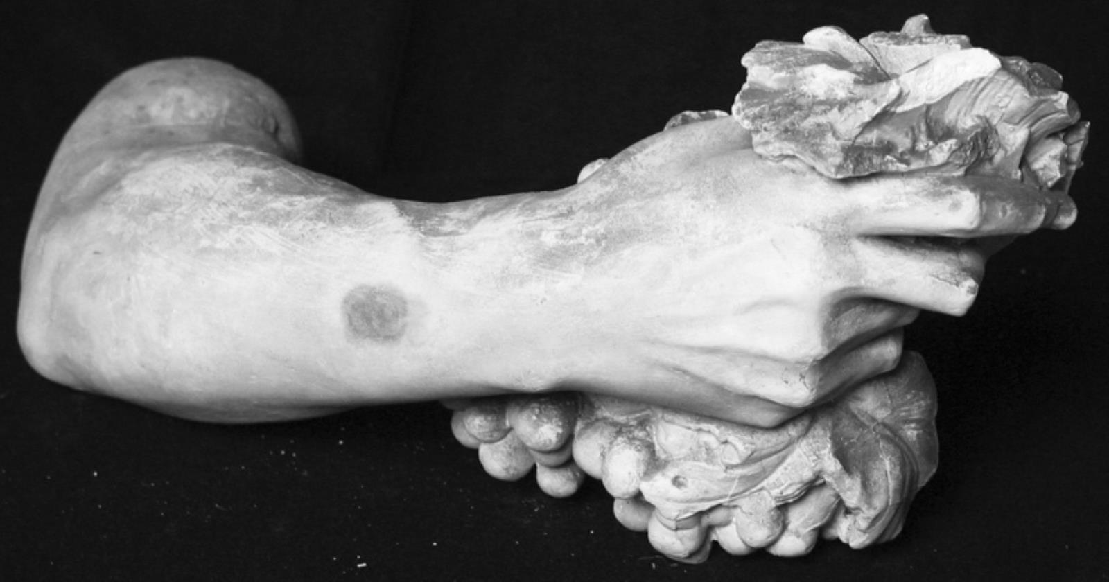 Arm with cluster of grapes